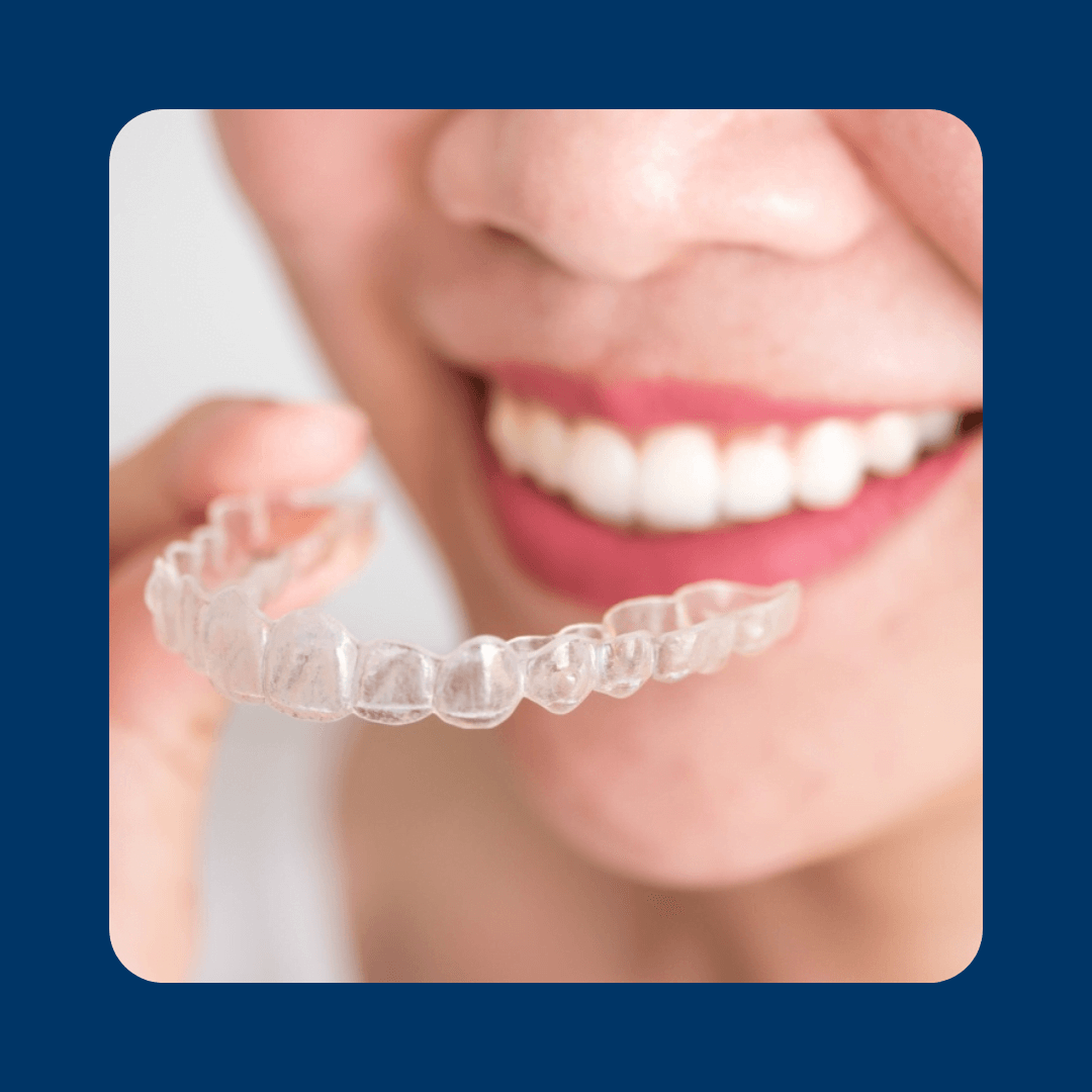 Invisalign treatment