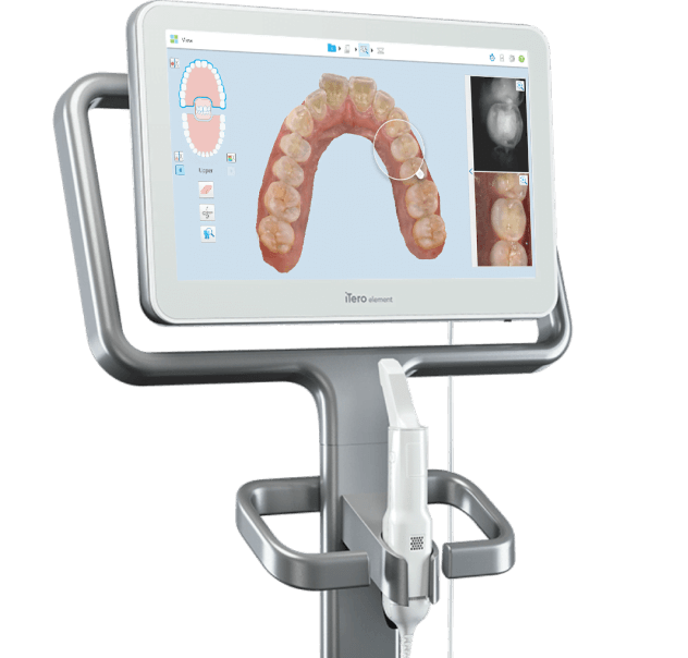 3D dental scanning technology