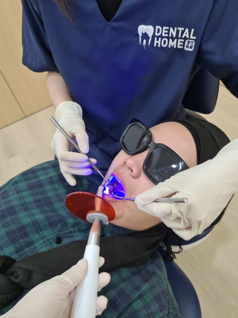 Dental filling service for tooth cavities