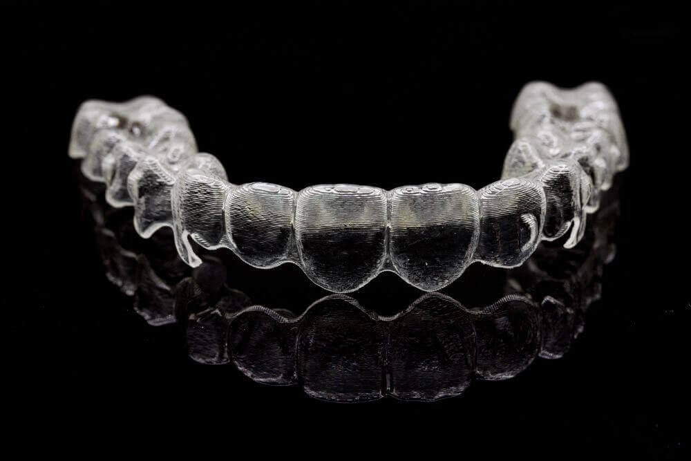 clear aligners 01 dental home dental clinic