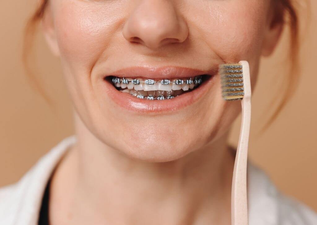 Just got braces? Learn how to brush your teeth with braces.