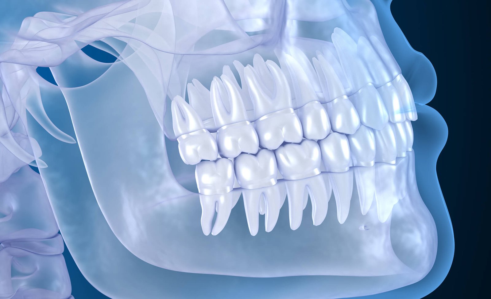 dental implant scan