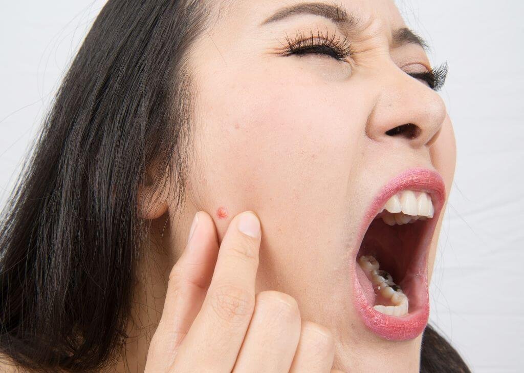 6 Wanita sakit disebabkan oleh gigi bongsu tumbuh.