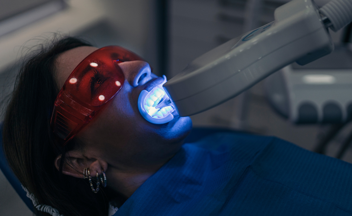 Teeth Whitening Treatment